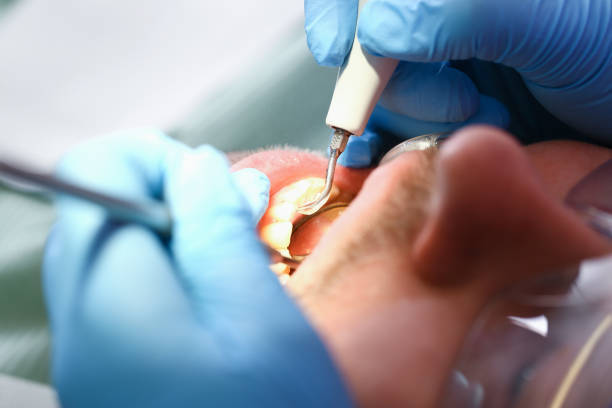 Best Mobile Emergency Dentist in Butner, NC