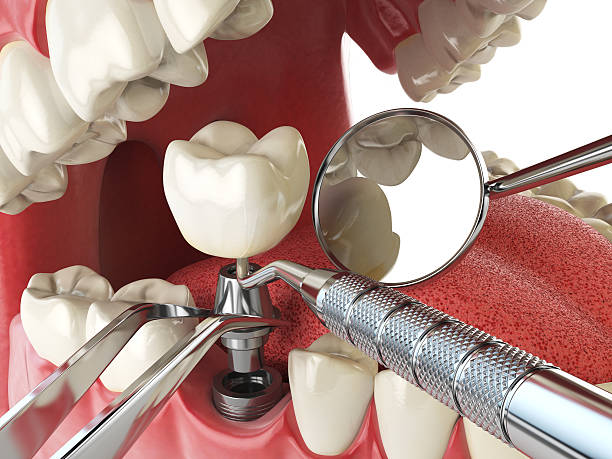 Best Holiday Emergency Dentist in Butner, NC